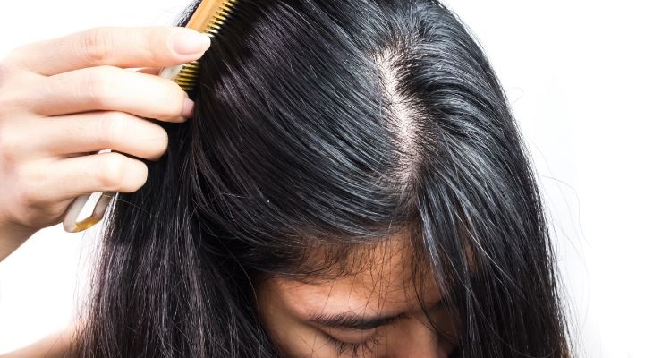 Capelli grassi