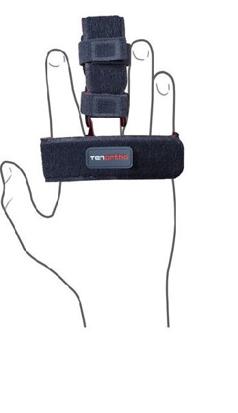 Tenortho Tutore Per Dita Taglia 2 Adulto-2