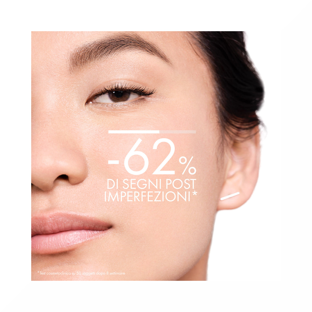 Vichy NORMADERM TRATTAMENTO QUOTIDIANO ANTI-IMPERFEZIONI 50 ml-12