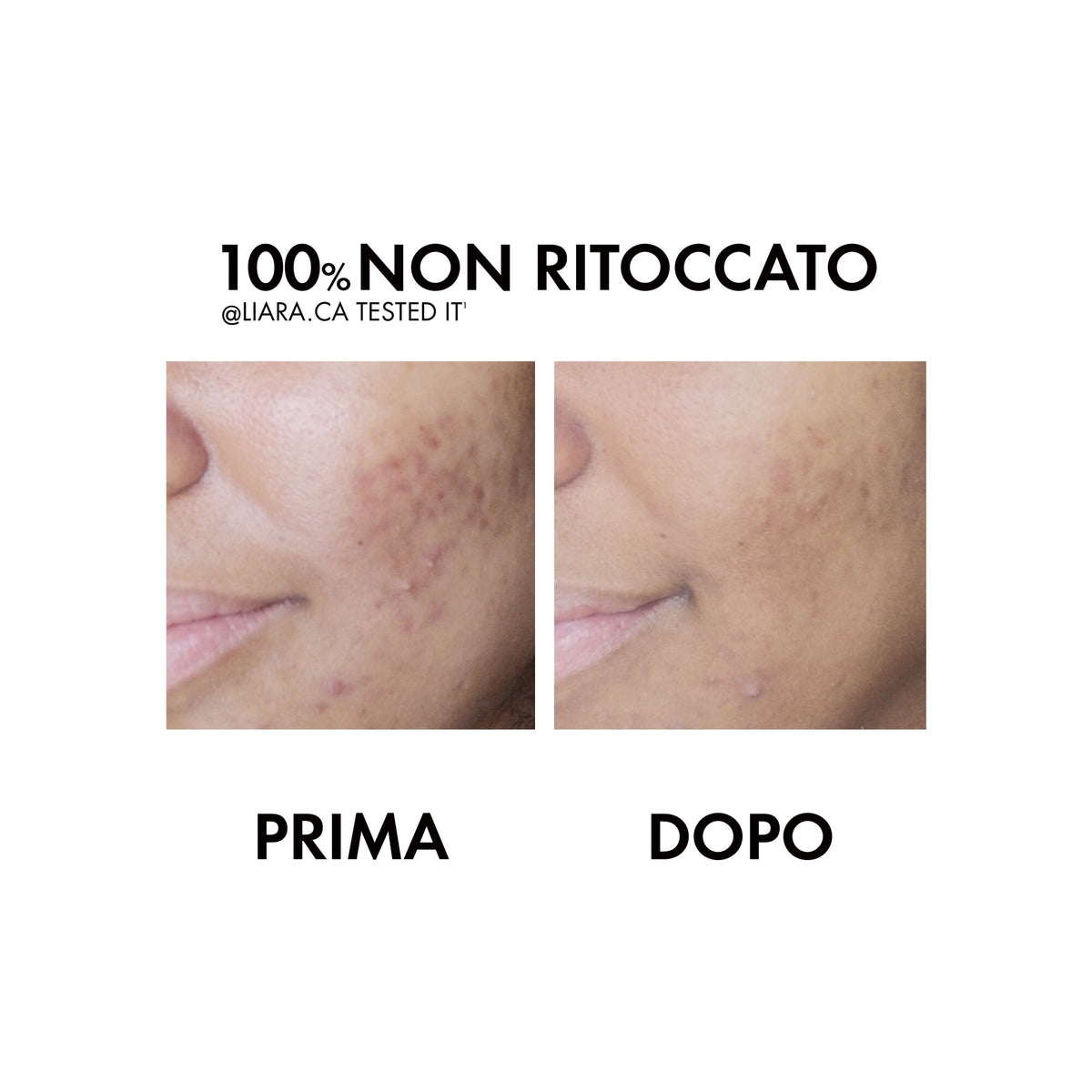 Vichy NORMADERM TRATTAMENTO QUOTIDIANO ANTI-IMPERFEZIONI 50 ml-13