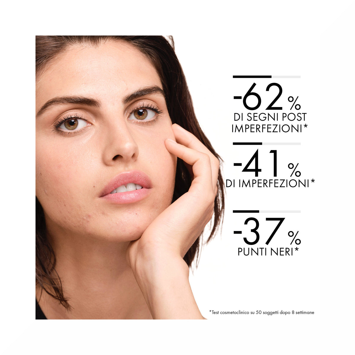 Vichy NORMADERM TRATTAMENTO QUOTIDIANO ANTI-IMPERFEZIONI 50 ml-20