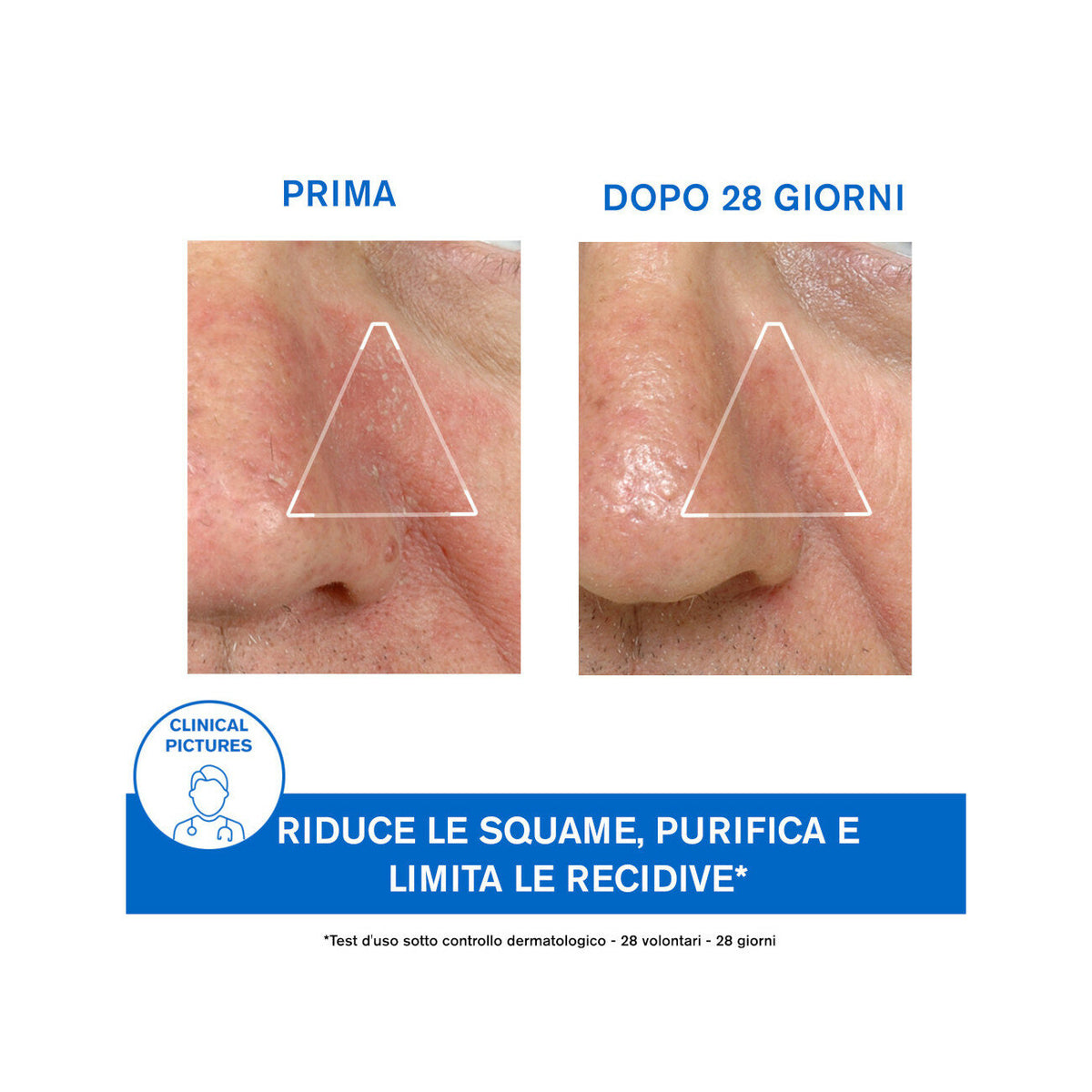 Uriage D.S. Emulsione 40ml-7