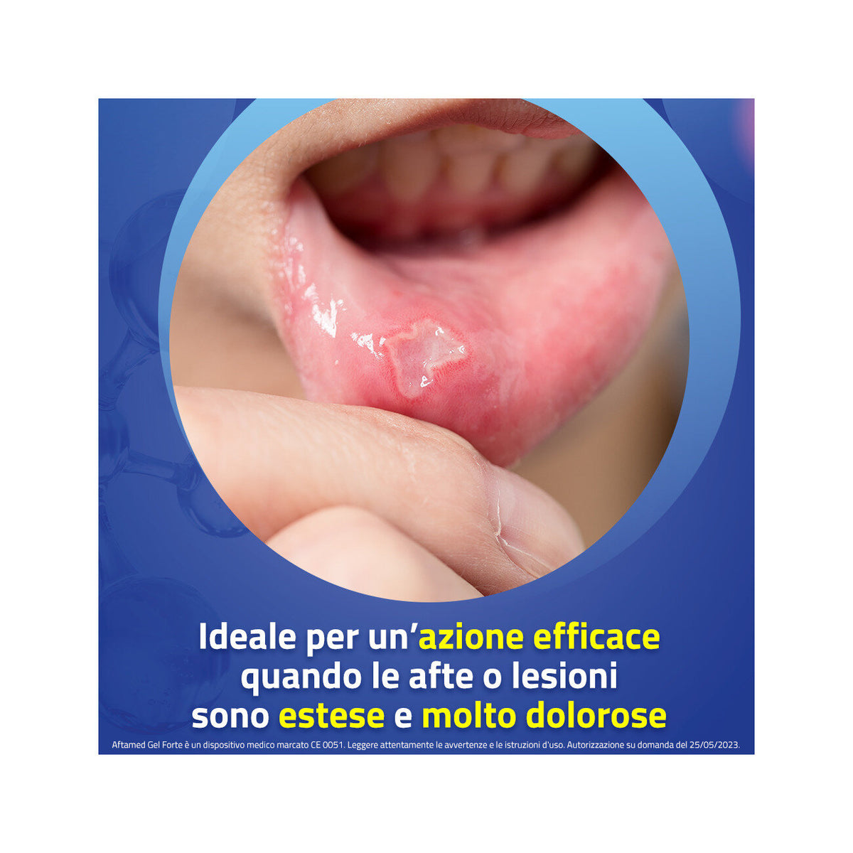 Aftamed Scudo gel ad alta densità 8ml-10