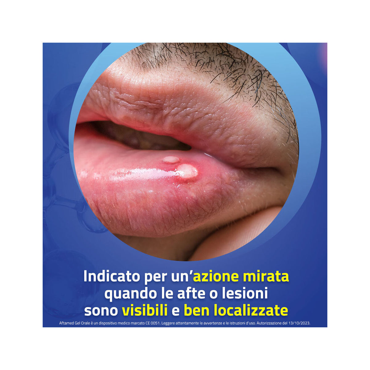Aftamed Gel Orale 10ml-5