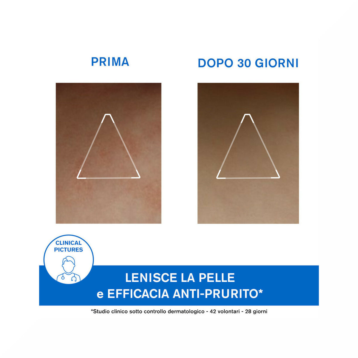 Uriage Xémose Cerato liporestitutivo anti-irritazioni 200ml-9