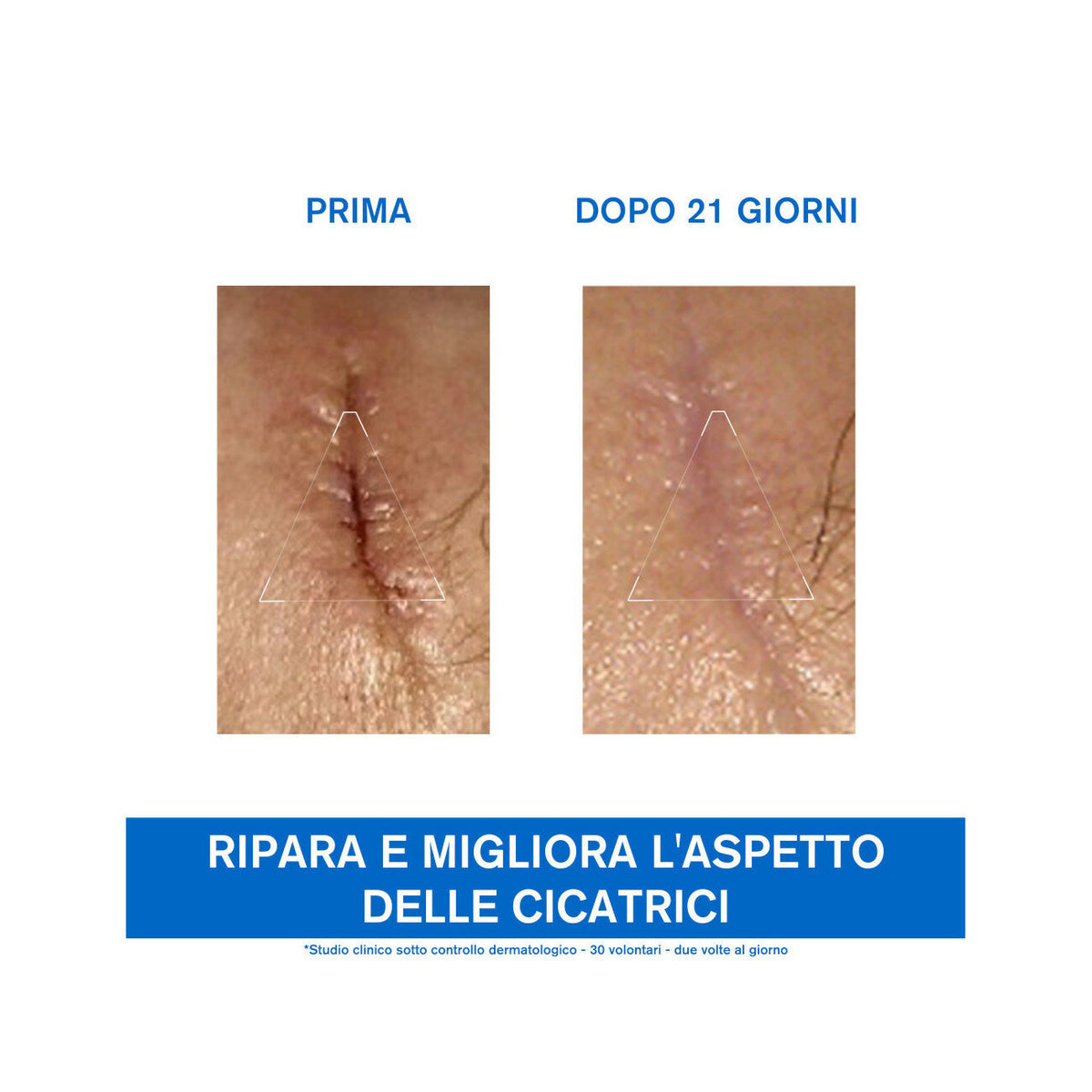 Uriage Bariéderm Cica-Crema Cu-Zn riparatrice 40ml-4