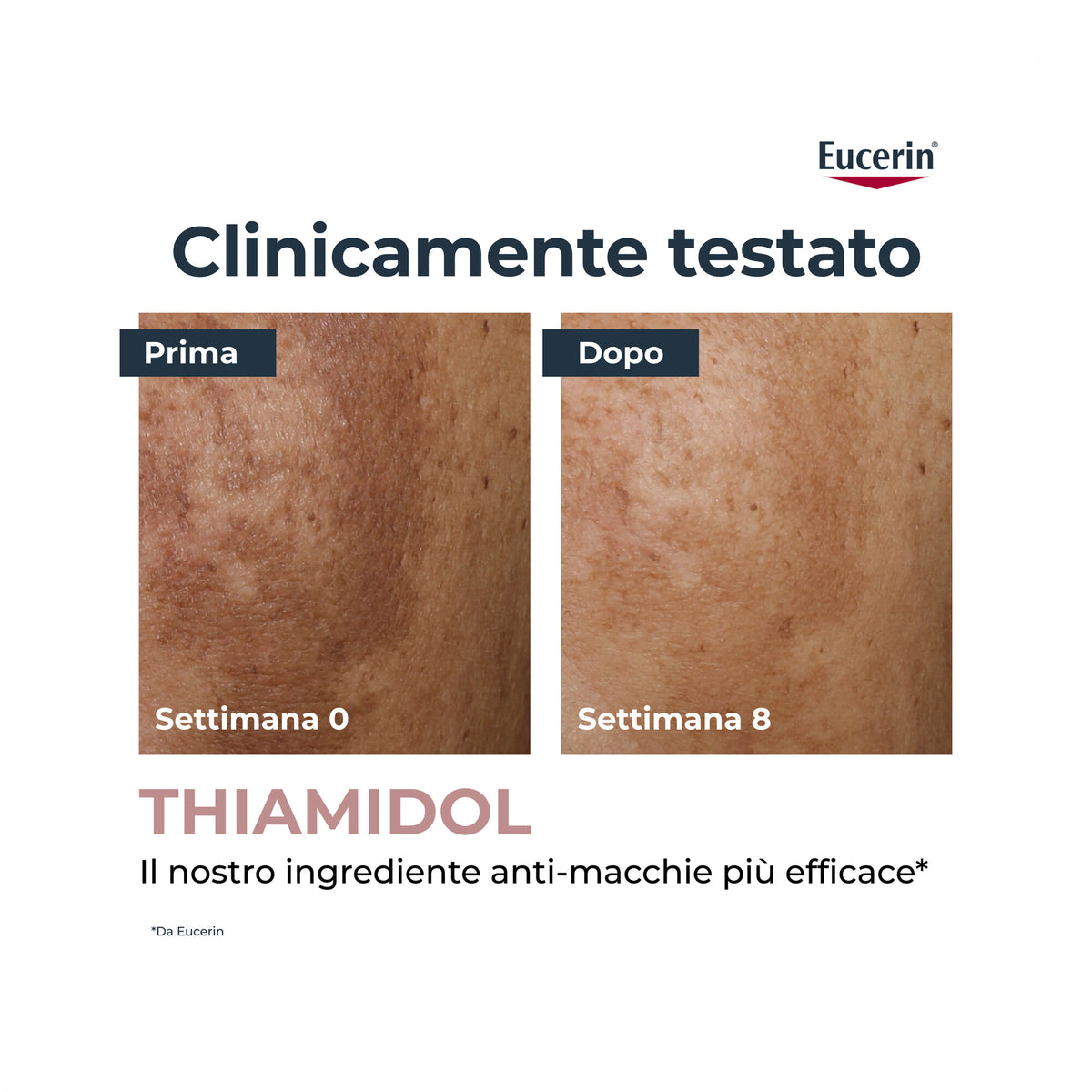 Eucerin AntiPigment Correttore anti-macchie 5ml-3