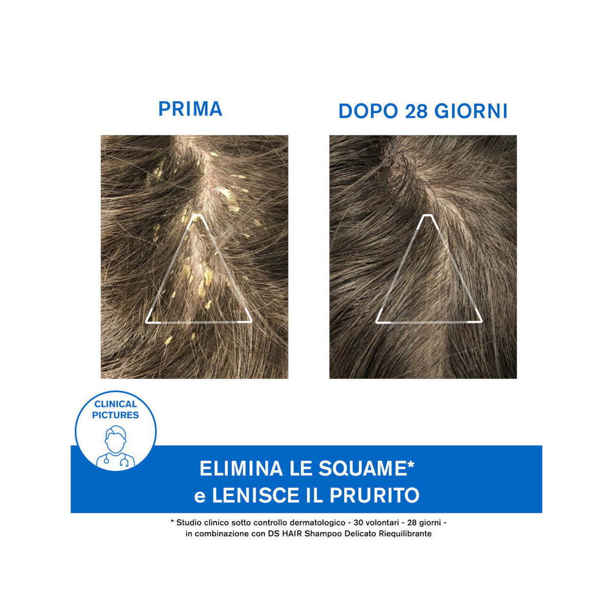 Uriage DS Hair Shampoo Trattamento Cheratoriduttore 150ml-9