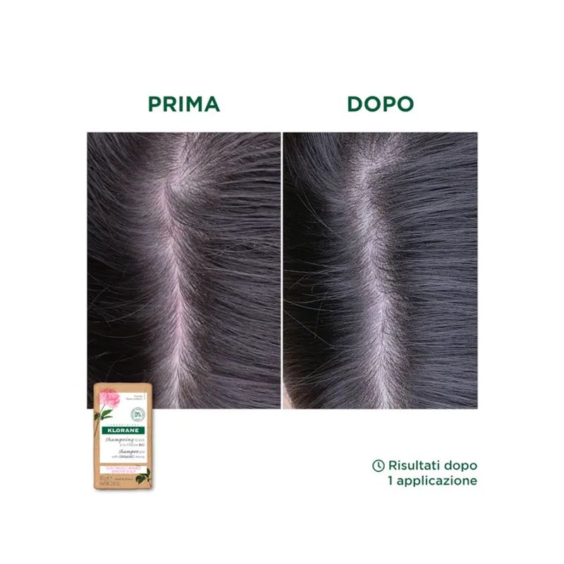 Klorane Shampoo Solido Lenitivo Peonia Bio 80g-5
