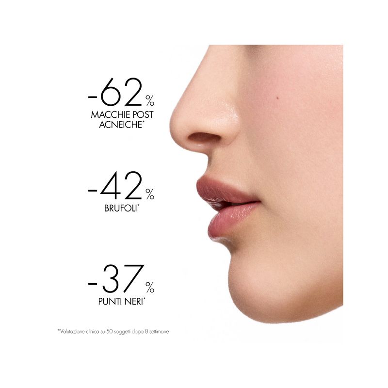 Vichy NORMADERM TRATTAMENTO QUOTIDIANO ANTI-IMPERFEZIONI 50 ml-3